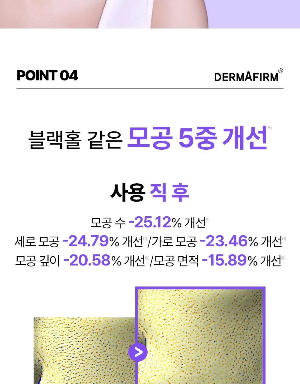 [흔적케어크림] 더마펌 수딩 리페어 토닝 크림 R4 50ml 기획 (+30ml) 상세페이지 26